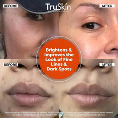 TruSkin Vitamin C Face Serum