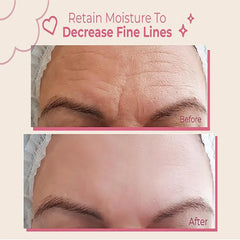 RISQUE Forehead Wrinkle Patches (2 Pairs)