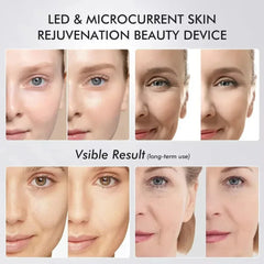 Booster Pro Led Facial Light 5 Colors Eye Beauty Wand Red Light Eye